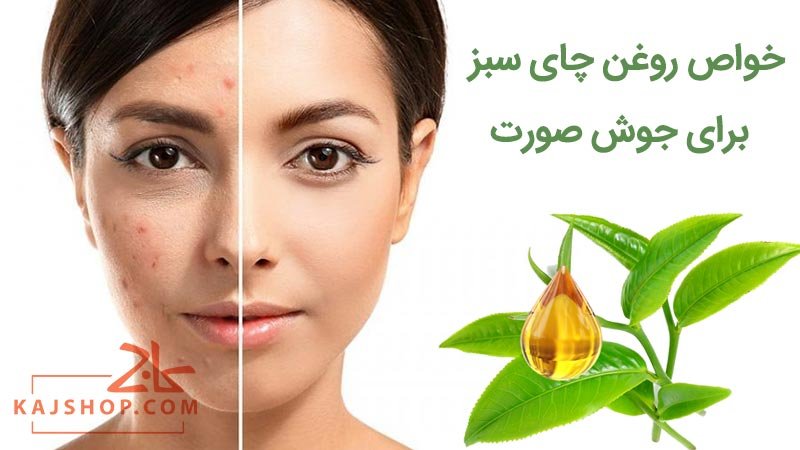 خواص روغن چای سبز برای جوش صورت